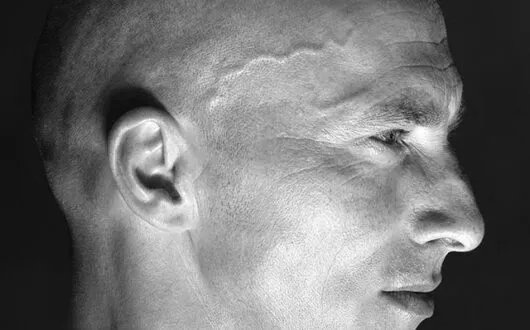 sAMSON-pIERRE-atlantide-nantes